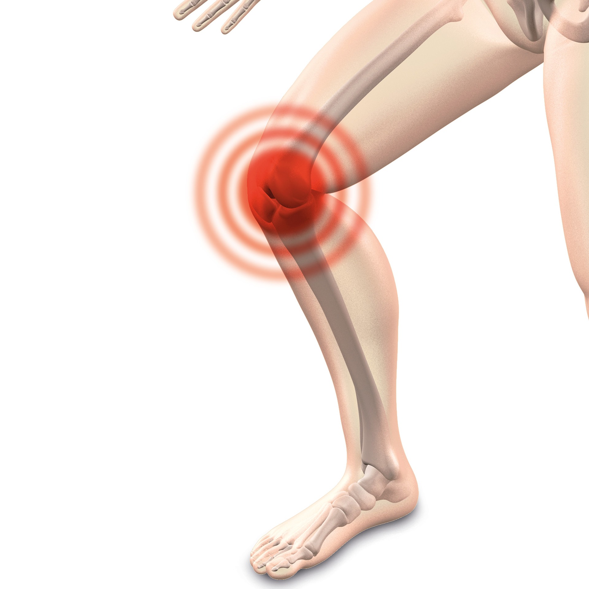 Knee Pain when you Squat or Run